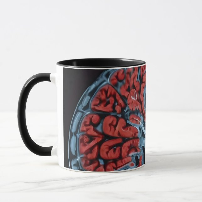 Mug Analyse cérébrale par IRM (Gauche)
