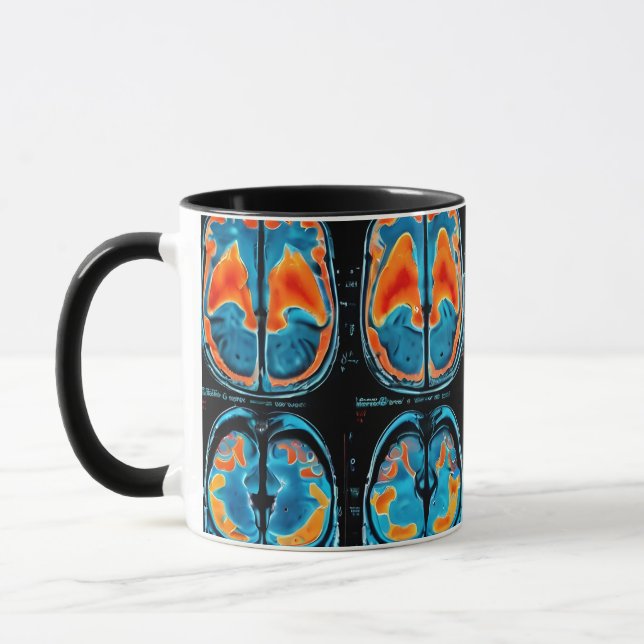 Mug Analyse cérébrale par IRM (Gauche)