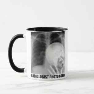 MUG BOMBE PHOTO RADIOLOGISTE