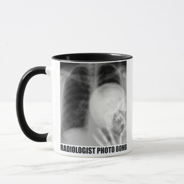 MUG BOMBE PHOTO RADIOLOGISTE (Gauche)