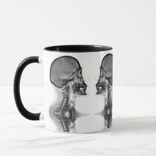 Mug Canette Radiologique