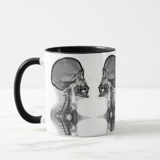 Mug Canette Radiologique