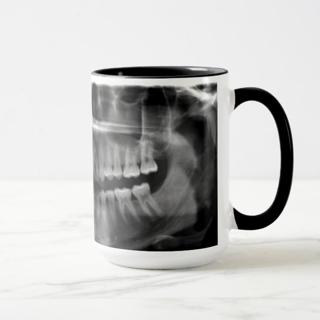 Mug Canette Rayons X Panoramiques (Droite)