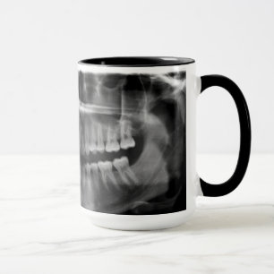 Mug Canette Rayons X Radiologie