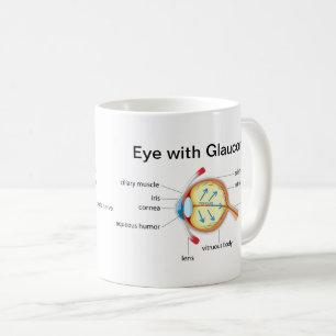 Mug Diagramme des yeux pour le glaucome et les yeux en