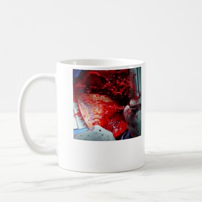 Mug Dissection aortique croissante (Gauche)