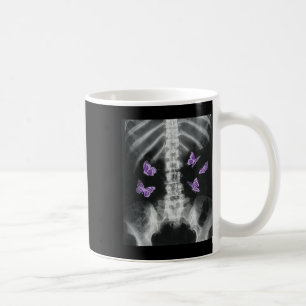 Mug Egirl Xray Squelette rose Papillon Harajuku Y2k Da
