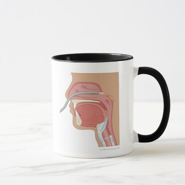 Mug Endoscopie du nez (Droite)