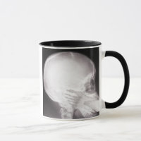 Foot à Mouth X-Ray