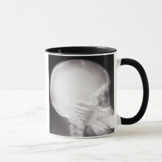 Mug Foot à Mouth X-Ray