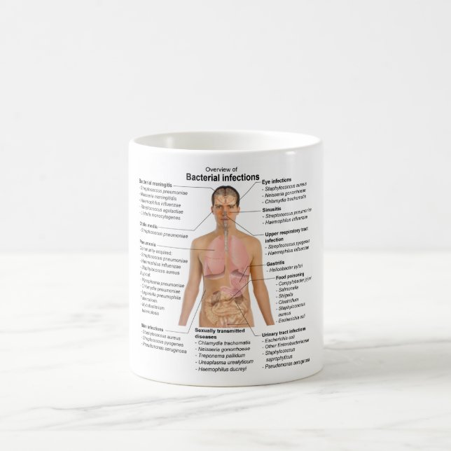 Mug Graphique des infections bactériennes chez l'homme (Centre)