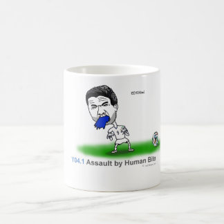 Mug ICD-10 : Assaut Y04.1 par la morsure humaine