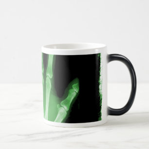 Mug Magic Main verte de squelette de rayon X