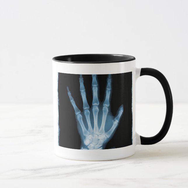 Mug Main bleue de squelette de rayon X (Droite)