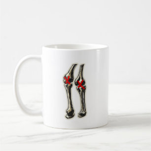 Mug Mauvais Genoux – Illustration Drôle de Squelette d