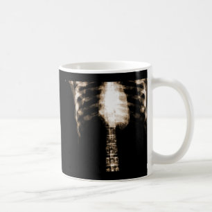 MUG NERVURES SQUELETTIQUES DE TORSE DE RAYON X - SÉPIA
