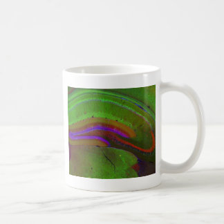 Mug Neurones de Hippocampal