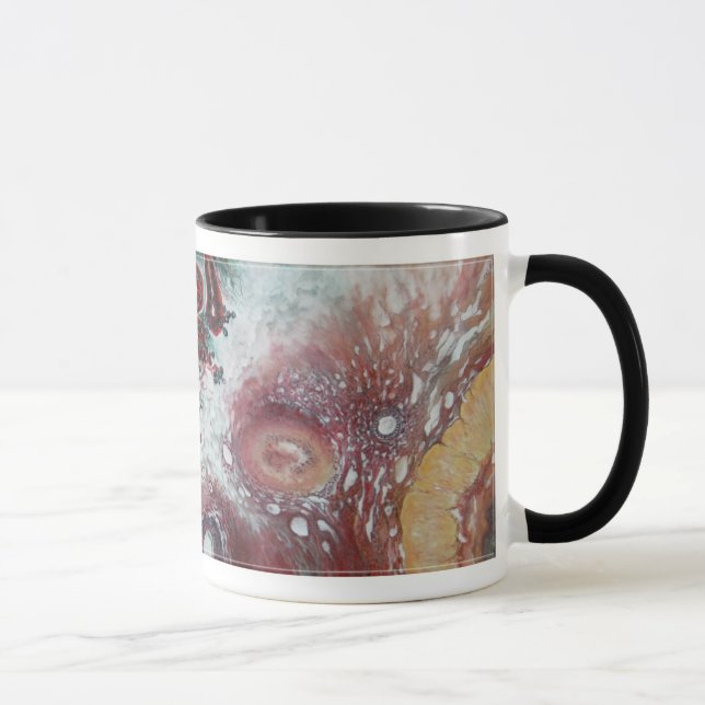 Mug Nouveau ! "Struma malin personnalisable Ovarii " (Droite)