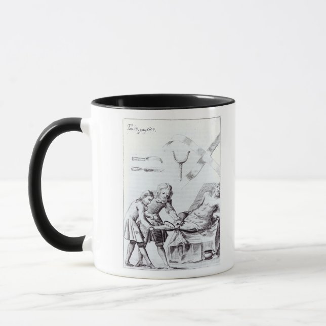 Mug Opération chirurgicale pour amputer une jambe (Gauche)