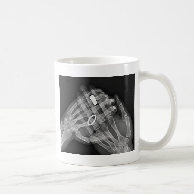 Mug Participation de main (Droite)
