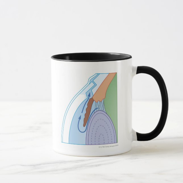 Mug Procédure de trabéculectomie (Droite)