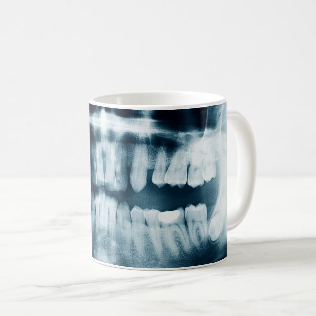 Mug Rayon X des dents (Devant droit)