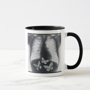 Mug Rayon X des papillons dans l'estomac