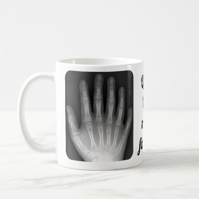 Mug Rayon X Polydactyl de main (Gauche)
