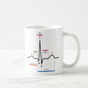 Mug Rythme de sinus dans un diagramme de