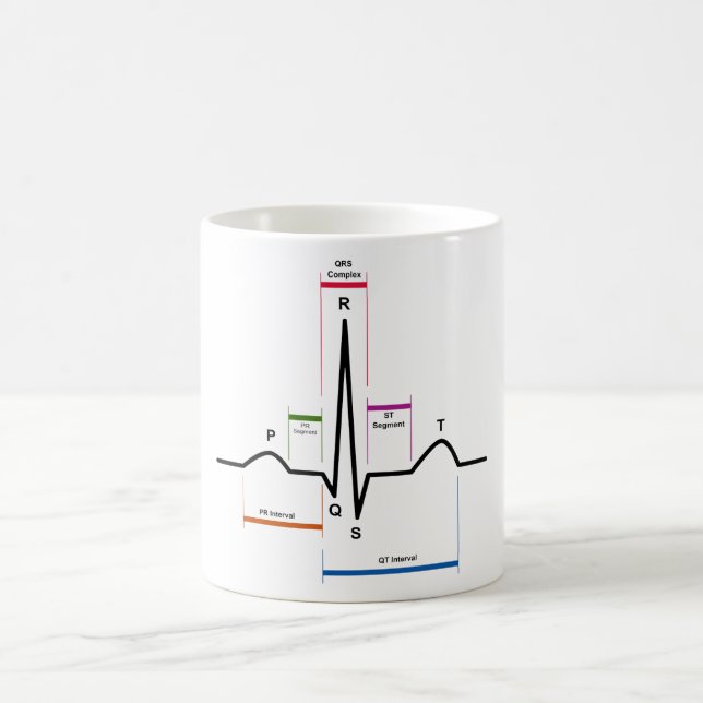 Mug Rythme de sinus dans un diagramme de (Centre)