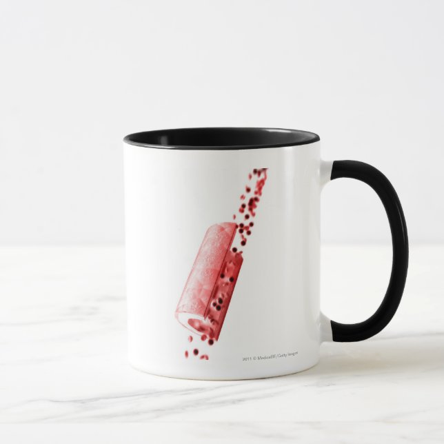 Mug Sang traversant une artère (Droite)