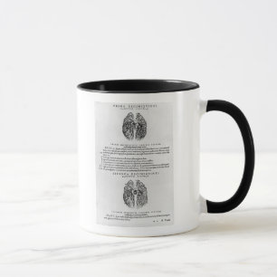 Mug Système vasculaire du cerveau