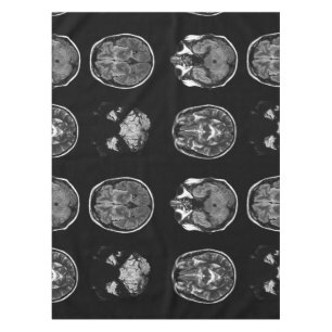 Nappe Analyse IRM du cerveau