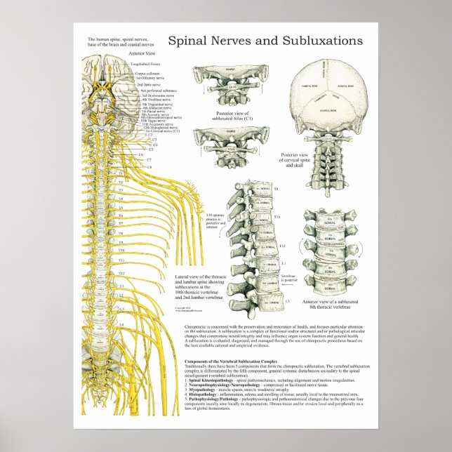 Nerfs épineux et subbluxes Poster chiropratique (Devant)