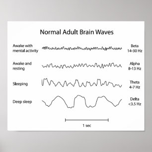 Ondes normales du cerveau adulte eeg Poster