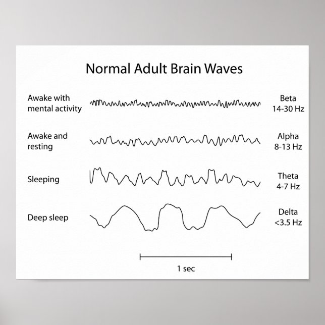 Ondes normales du cerveau adulte eeg Poster (Devant)