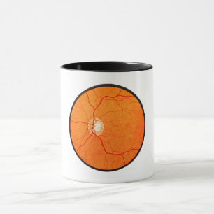 Ophtalmologie Optométrie Oeil Fundus Exode Mug