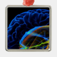 Image de rayon X du cerveau