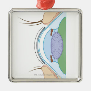 Ornement Carré Argenté Lentille de contact souple