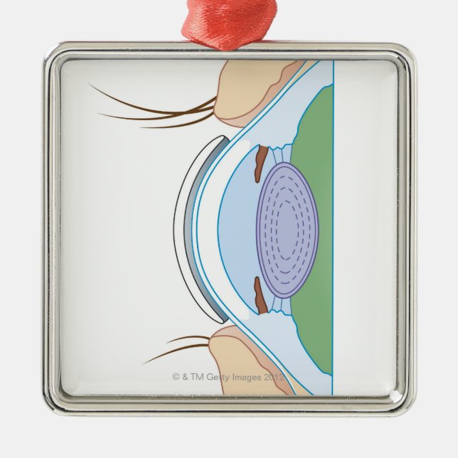 Ornement Carré Argenté Lentille de contact souple (Devant)