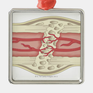Ornement Carré Argenté Os se réparant 2