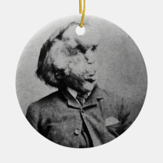 Ornement En Céramique Joseph "John" Merrick L'homme éléphant de 1889 (Devant)