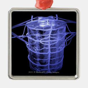 Ornement En Métal Artères entourant une partie de la colonne