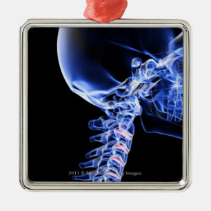 Ornement En Métal Radiographiez l'image des os du cou