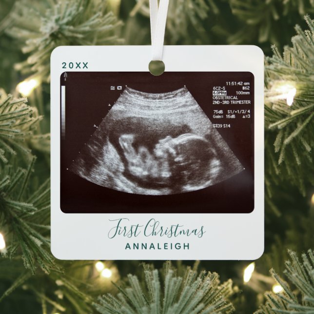 Ornement En Métal Ultrasonic Photo First Christmas Sonogram Holiday (Insitu)