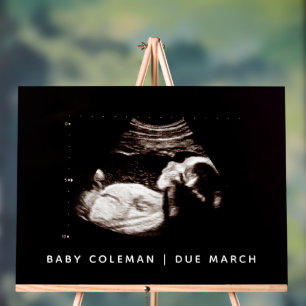 Panneau En Acrylique Sonogramme de Baby shower de grossesse