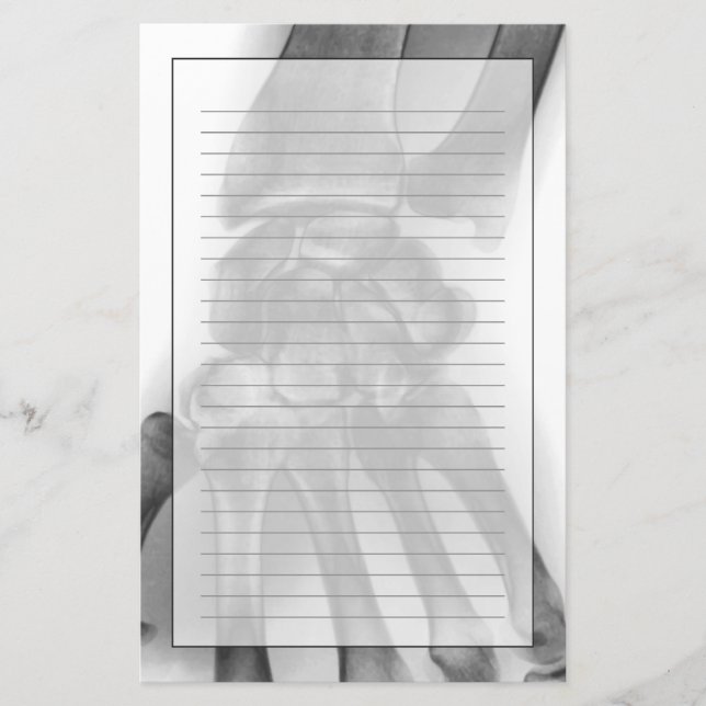 Papeterie Poignet normal, rayon X (Devant)