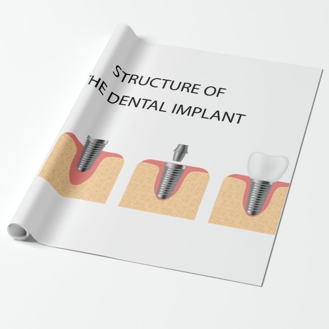 Papier Cadeau Structure de l'implant dentaire (Déroulé)