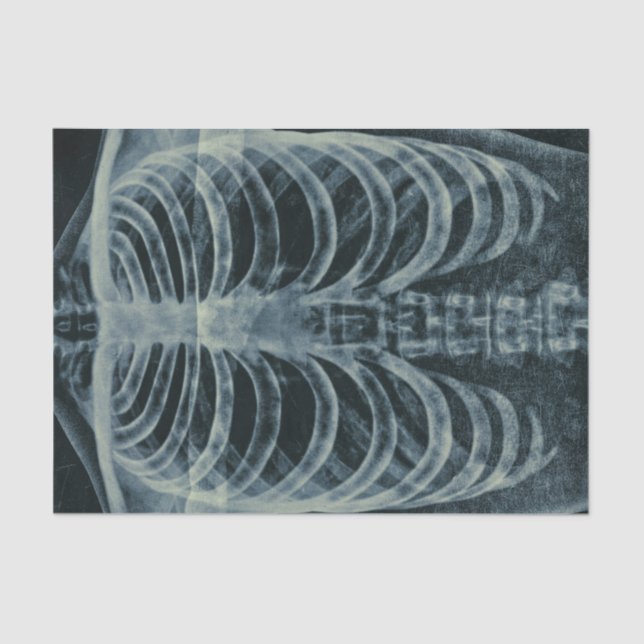 Papier Mousseline Squelette vintage noir et blanc Xray (Recto)