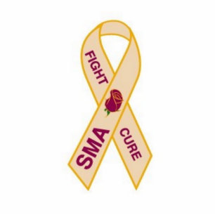 Photo Sculpture Fin-SMA-goupille